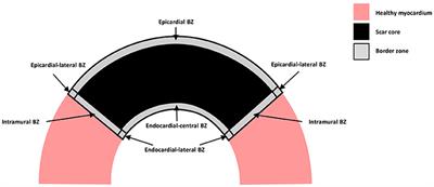 Modeling the Electrophysiological Properties of the Infarct Border Zone